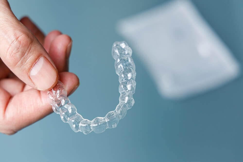 Macquarie Dentists - a hand showing Invisalign