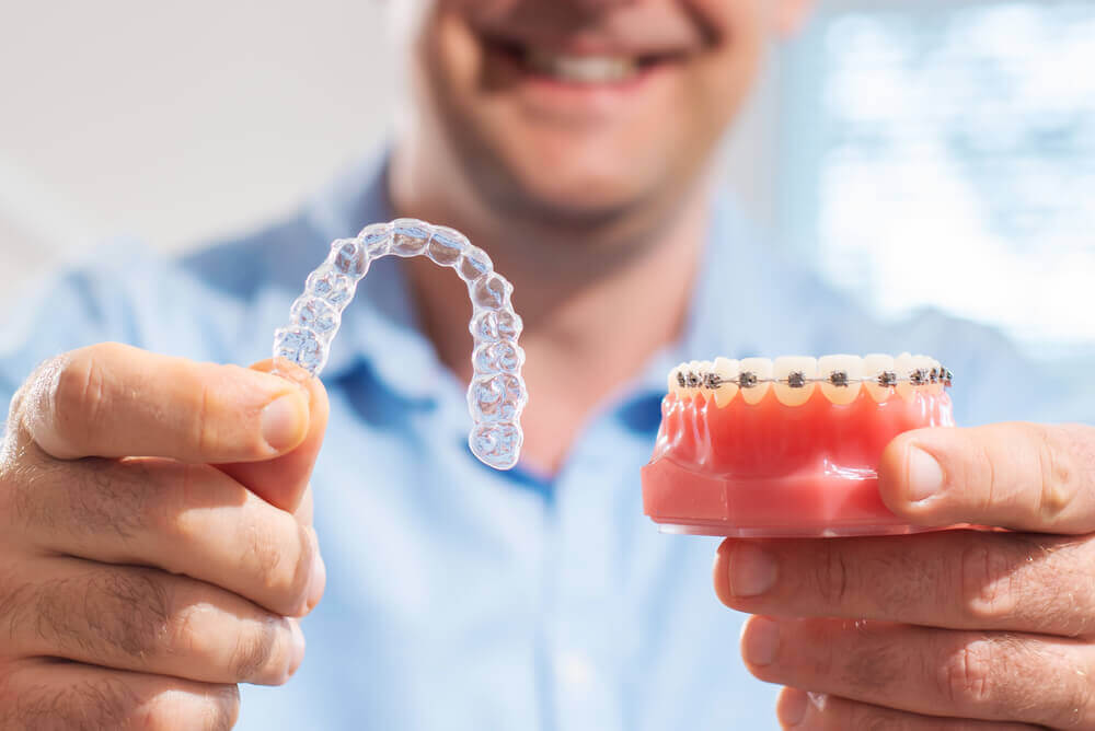 Macquarie Dentists - man holding Invisalign and metal braces