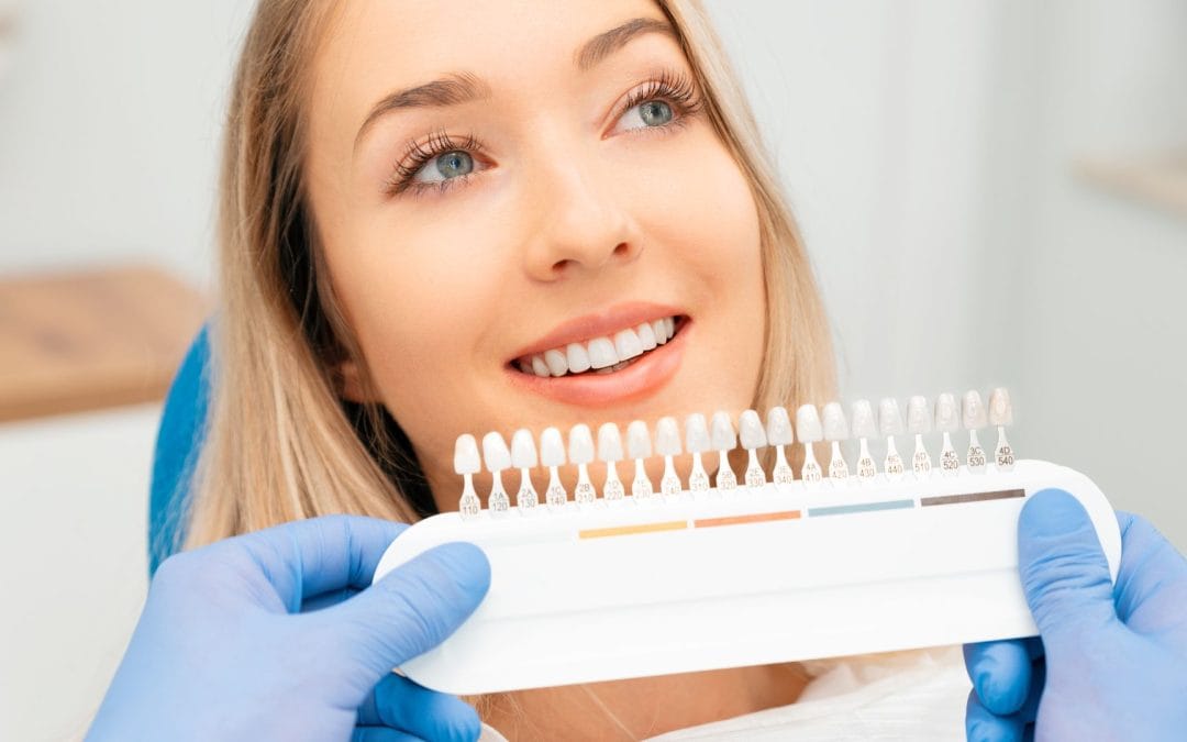 Young woman at a Macquarie Park dental clinic smiling as a cosmetic dentist matches porcelain veneer shade using a tooth colour guide before veneer placement.